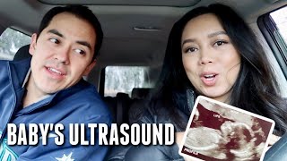 Baby's Anatomy and Gender Ultrasound! - itsjudyslife