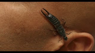КАК ВЫТАЩИТЬ ТАРАКАНА ИЗ УХА.МОЯ РЕАЛЬНАЯ ИСТОРИЯ