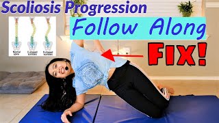 Scoliosis 2nd Part Series Progression  Follow Along Exercises