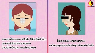 อยากศัลยกรรม ต้องเลือกคลีนิกที่ถูกกฏหมายและมีคุณภาพนะ อย่าเน้นแต่ของถูก