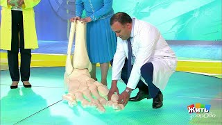 Плоскостопие и шишки на ногах. Жить здорово! (13.10.2017)