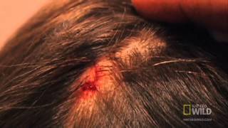 Оводы  - человеческий кожный овод (лат. Dermatobia hominis)