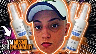 Antiacne Funciona? Antiacne É Bom? Antiacne Como Usar? Antiacne Onde Comprar? Cuidado!!!