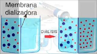 Documental Hemodialisis