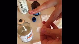 Лечение дакриоцистита без зондирования. Blocked tear duct