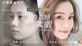 Dr. Milano｜哀怨妹變身自然系混血感! Ann雙眼皮&自肋韓鼻經驗分享｜米蘭時尚診所