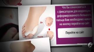 valgus pro отзывы

  - Уникальный фиксатор Valgus Pro