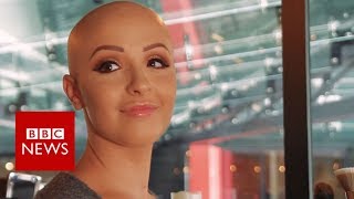 Making hair loss 'fashionable' - BBC News