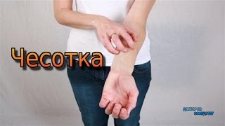 ЧЕСОТКА / SCABIES