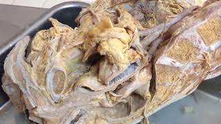 Urinary bladder