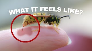 ?POOL PARTY EMERGENCY BEE STING! ? | Slyfox Family