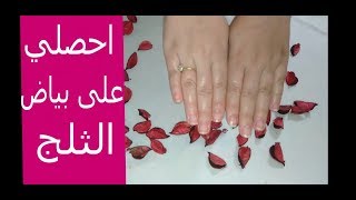 الوصفة القنبلة لتفتيح وترطيب اليدين بعد حروق الشمس و مواد التنظيف