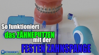 ZÄHNEPUTZEN mit der FESTEN ZAHNSPANGE | Orthodentix