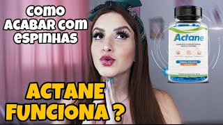 Actane Funciona? Actane é Bom? Onde Comprar e Como Usar este AntiAcne?