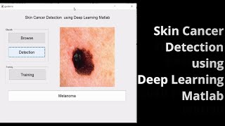 Skin Cancer Detection using Deep Learning Matlab