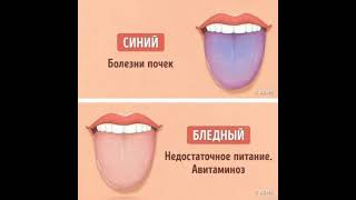 Диагностика ковид. Простая диагностика здоровья #диагностика #здоровье