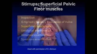 Female Pelvic Pain Examination - Stirrups