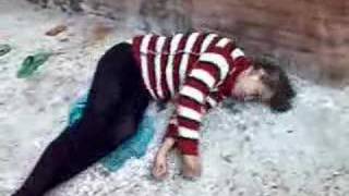 Эпилептический припадок Epileptic attacks