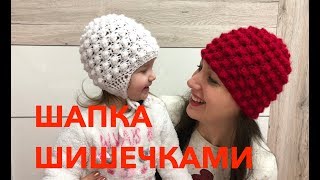 МК: ШАПКА ШИШЕЧКАМИ⎜на годик и большая
