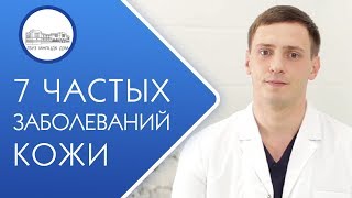 ? 7 распространённых вирусных заболеваний кожи: признаки и лечение. Вирусные заболевания кожи. 12+