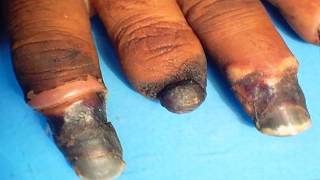 YouTube's Greatest Cysts Presents, Mysteries from the Morgue!