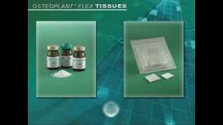 Использование материала Bioteck OSTEOPLANT FLEX SPONGY гибкий губчатый костный блок) при синус лифти