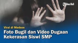 Foto Bugil dan Video Dugaan Kekerasan Siswi SMP di Buleleng Viral di Medsos