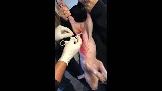 Rupture fix on a pig