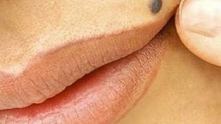 РОДИНКИ и РОДИМЫЕ ПЯТНА