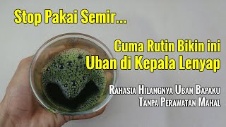 MASIH MUDA SUDAH UBANAN??? HILANGKAN SEKARANG JUGA DENGAN CARA INI