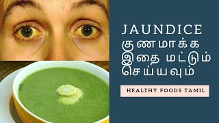 How to Cure Jaundice  Naturally at Home | Healthy Foods Tamil