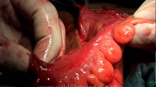 Going under the knife