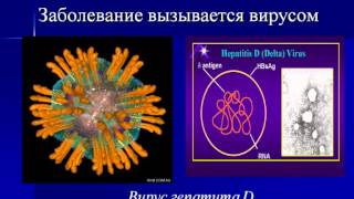 Вирусные гепатиты