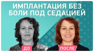 Полное восстановление зубов за пару дней ? отзыв спустя 6 месяцев после имплантации