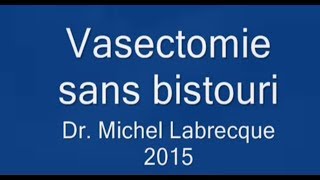 Un aperçu de la vasectomie sans bistouri