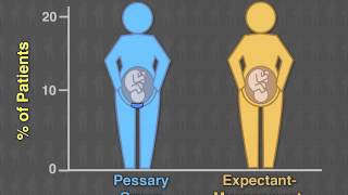 Cervical Pessary to Prevent Preterm Birth?