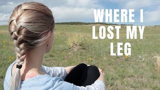 COME WITH ME: WHERE I LOST MY LEG & BECAME AN AMPUTEE (15 years ago)   [cc]
