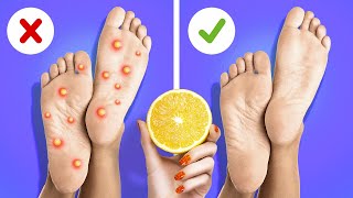 Awesome Hacks For Your Feet And Shoes