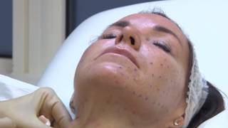 Dr Kuldeep Minocha Restylane Skinboosters
