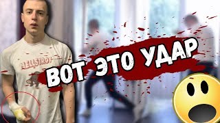 МЕЛЛСТРОЙ [] ЖЕСТЬ [] РАЗБИЛ ОКНО ГОЛЫМ КУЛАКОМ [] ВЫИГРАЛ В КАЗИНО [] VINE