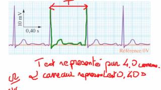 Méthode pour la mesure de la fréquence d'un signal périodique