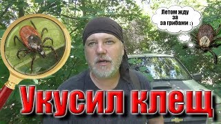 Укусил?клещ! Как вытащить клеща и какие последствия! Was bitten by a tick!