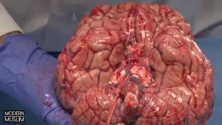 HOW PORN CHANGES THE BRAIN
