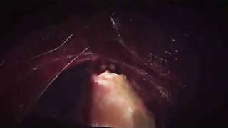 Romantic Zoe (Consensual Vore,Digestion,Same Size,Mostly Commentary.)