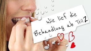 Die Behandlung mit dem CA® CLEAR ALIGNER Teil 2 - Start to love your smile