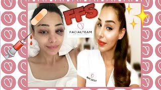 FFS - MY FOREHEAD BOSSING/REDUCTION WITH FACIALTEAM | Pari