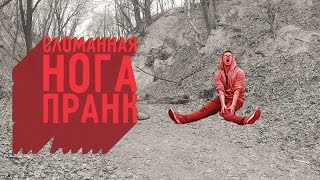 Сломанная Нога / Broken Leg Prank