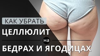Как убрать ЦЕЛЛЮЛИТ на БЕДРАХ и ЯГОДИЦАХ в домашних условиях.
