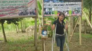Irene, right above the knee RAK amputee model, introduction