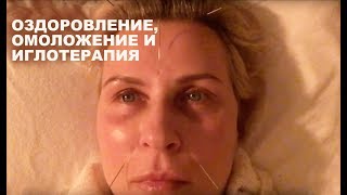 ?ОЗДОРОВЛЕНИЕ, ОМОЛОЖЕНИЕ И ИГЛОТЕРАПИЯ (часть3). Inna Gonka, E673
